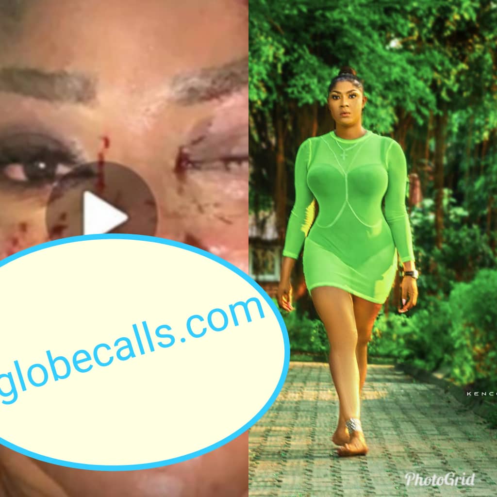 Photos Of Angela Okorie After She Reportedly Survived 14 Bullets From Armed Robbers.