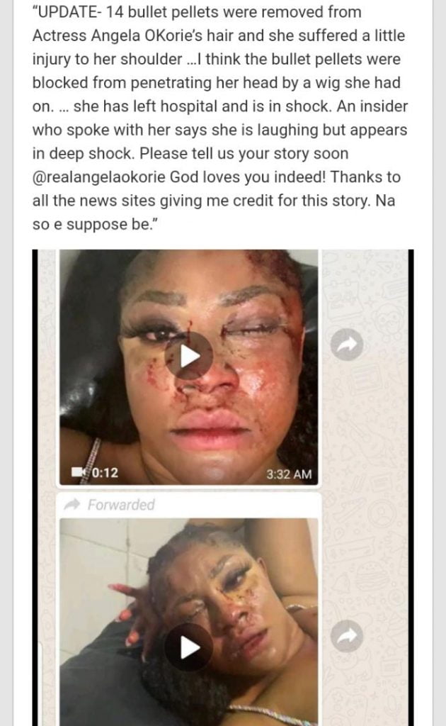 Photos Of Angela Okorie After She Reportedly Survived 14 Bullets From Armed Robbers. 2 » Tech And Scholarship Updates