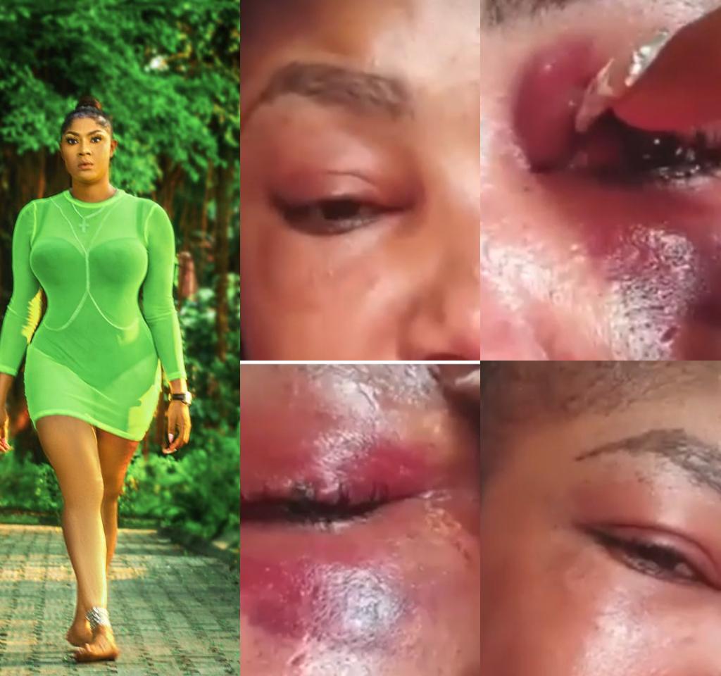 Video: Angela Okorie Speaks For The First Time After Her Attack, Shows x-ray Of Bullet Holes In Her Skull. 1 » Tech And Scholarship Updates