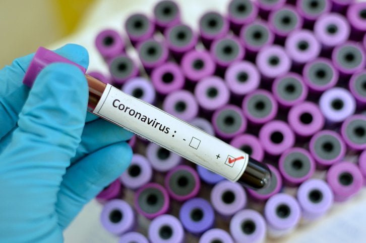 Corona virus cases in Ghana Jumps To 52.