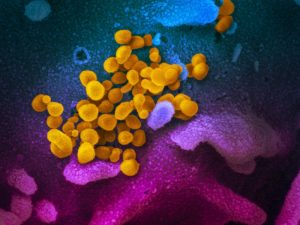 Dangote Donates $550k To Fight Coronavirus 2 » Tech And Scholarship Updates