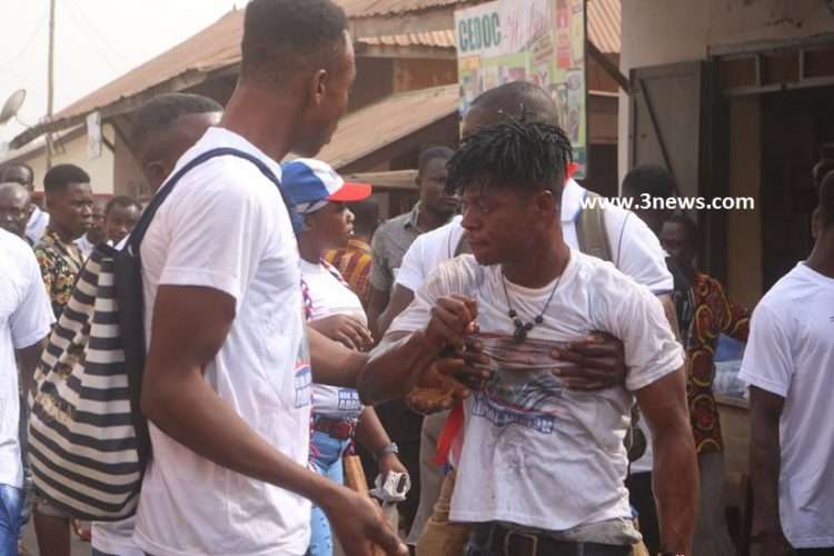 NPP Supporters Wounded In A Clash At Mampong. 1 » Tech And Scholarship Updates