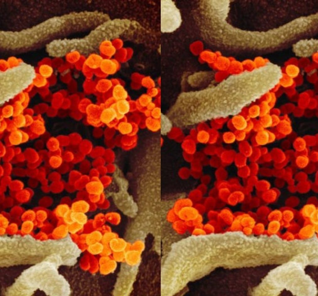 See How Coronavirus Looks Like Under Microscope