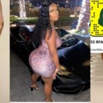IG Model With Failed Plastic Surgery Advises Ladies Against The Act