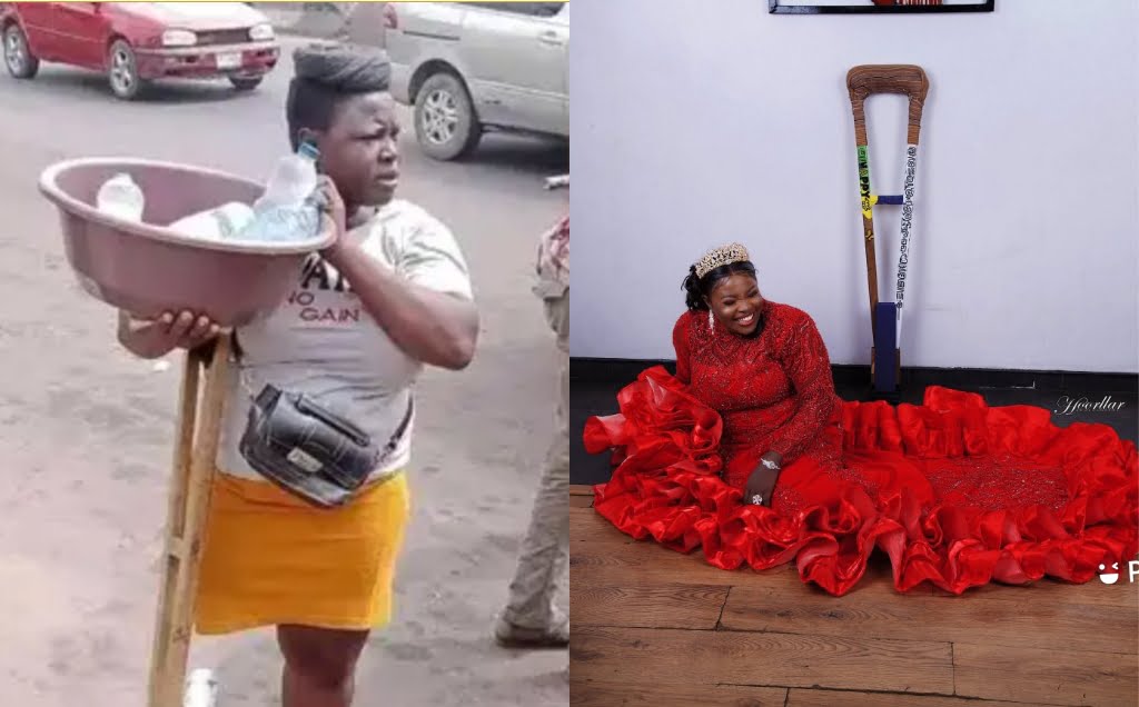 Highly Favoured Amputee Hawker Transforms Into A Top Model